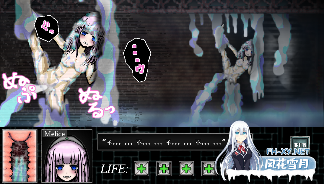 [SLG/汉化/动态/PC+安卓] 异形病栋/異形病棟 精翻汉化版 [266M]-1.png